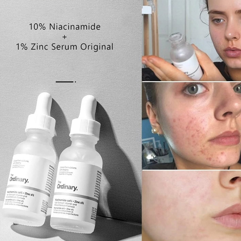 The Ordinary Niacinamide 10% + – Luxury Skincare Brands recenzja i cena